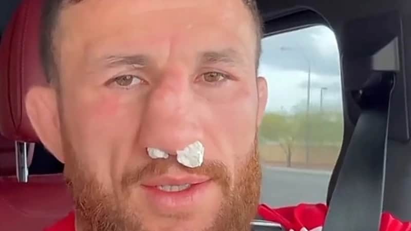 ¿Qué le pasó a Merab Dvalishvili en la Nariz?