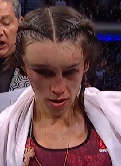 La luchadora de mma polaca Joanna Jedrzejczyk después de su pelea de ufc contra Zhang Weili con la cara completamente deformada